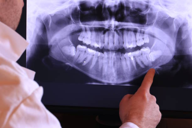 Best Emergency Dental Services for Seniors in Hailey, ID